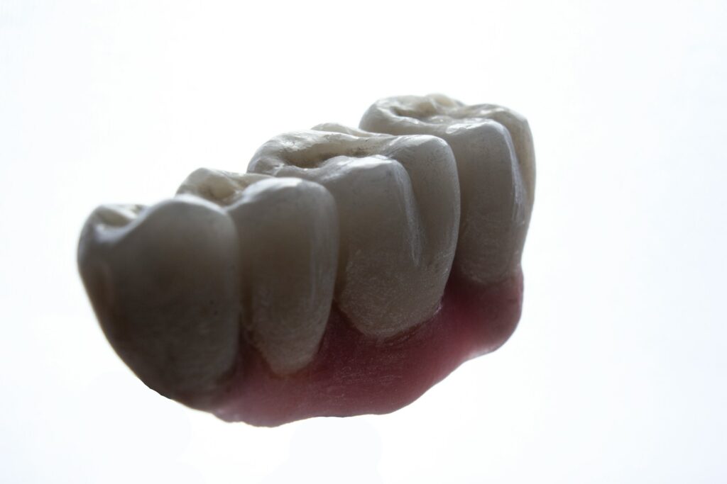 Dental Bridge