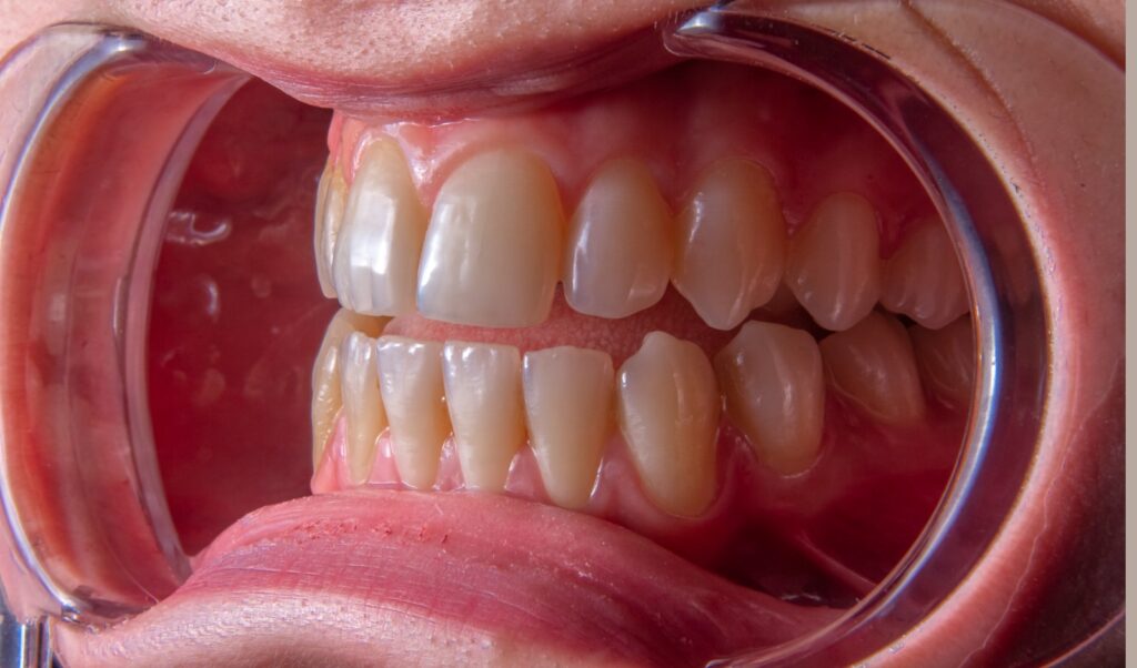 Periodontal Therapy